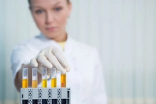 İdrarda Protein Belirtileri ve Tedavisi